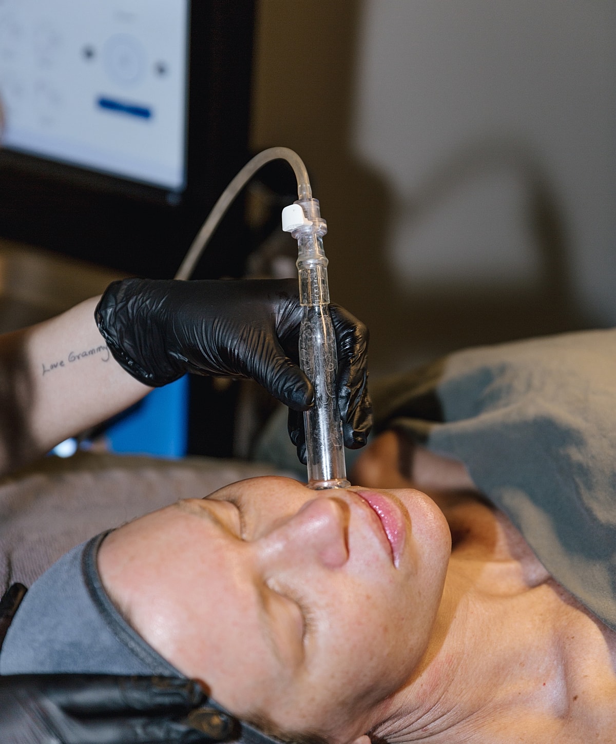 Woman receiving facial treatment with a suction device.