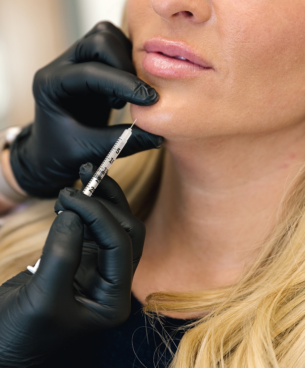 Injecting cosmetic treatment into woman's chin area